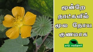 மூன்றே நாட்களில் மூல நோய் குணமாக  Thuthi ilai uses in Tamil  Abutilon Indicum for Piles [upl. by Onivag60]