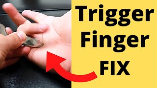 FIX Trigger Finger in 5 Minutes 3 Steps [upl. by Ahsele]