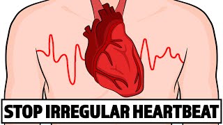 How to Fix your Irregular Heartbeat in Under 3 minutes [upl. by Alleynad641]