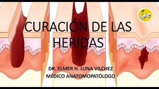 CURACIÓN DE LAS HERIDAS Dr Elmer H Luna Vilchez [upl. by Novj]