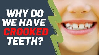 Why do we have crooked teeth  Dentist Explained 2021 [upl. by Eelyab582]