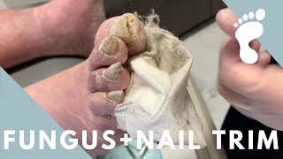 CRAZY THICK NAIL TRIM  FUNGUS [upl. by Trofmoc]