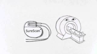 Medtronic SureScan Technology [upl. by Jeroma]