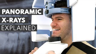 Panoramic Dental XRay Procedure EXPLAINED [upl. by Nylahs]