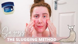 I Tried SLUGGING For A Week With ACNE Prone Skin [upl. by Arjan]