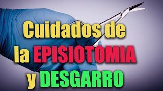 Cuidados de la EPISIOTOMÍA y DESGARRO perineal [upl. by Laekim]