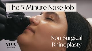 The 5Minute Nose Job 🟡 The NonSurgical Rhinoplasty by VIVA Skin Clinics [upl. by Hannie]