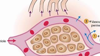 Mechanisms of edema development [upl. by Adnih701]