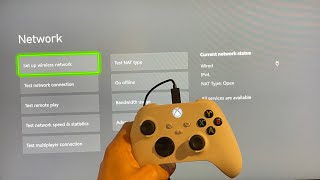 Xbox Series XS How to Fix Xbox Network Disconnecting Tutorial Boost Internet Speeds amp Reduce Lag [upl. by Aihpos]