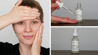 How to use The Ordinary Niacinamide 10  Zinc 1  Full Demonstration [upl. by Lateh]