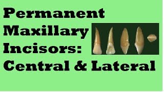 Permanent Maxillary Incisors [upl. by Laenej]