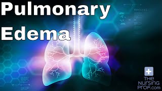 Nursing Emergencies Pulmonary Edema [upl. by Kuehnel]