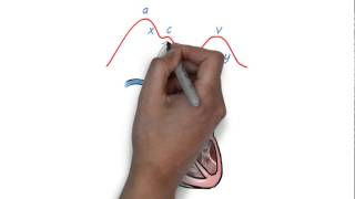 JVP waveform explained [upl. by Eceirtal]