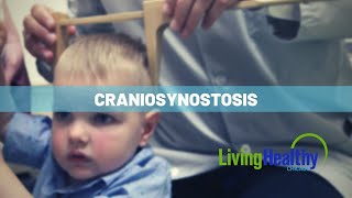 Diagnosis and Treatment of Craniosynostosis in Children [upl. by Aniaz]