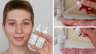 How to use The Ordinary Alpha Arbutin and Niacinamide together [upl. by Eirameinna]