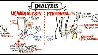 Failing Kidneys and Different Treatment Options [upl. by Caterina368]