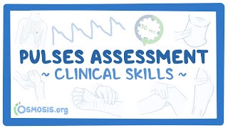 Clinical Skills Pulses assessment [upl. by Anaig27]