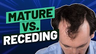 Mature Hairline Versus Receding Hairline  How To Tell The Difference [upl. by Yliak]