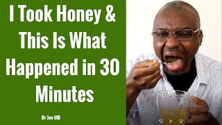 What Honey Did To My Blood Sugar in 30 Minutes Shocking [upl. by Valera]