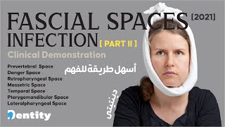 شرح مبسط  Fascial Spaces Infection  PART 22 [upl. by Rednaxela]