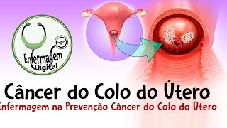 Câncer do Colo do Útero  Enfermagem na Prevenção [upl. by Noscire]