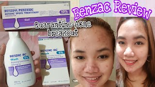 Benzac  Benzoyl Peroxide Review Benzac AC Wash 5 and Spots Treatment 10 [upl. by Charlie]