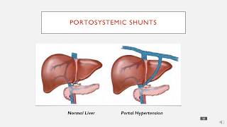 Portosystemic Shunts in 3 minutes [upl. by Laehcar]