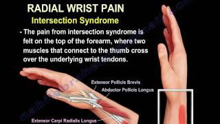 Wrist Paincauses and treatmentPart 2  Everything You Need To Know  Dr Nabil Ebraheim [upl. by Lovering]