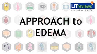 Approach To Edema [upl. by Yirinec282]