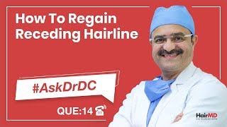 How To Regain Receding Hairline  AskDrDc Ep 14  HairMD Pune  In HINDI [upl. by Bender796]