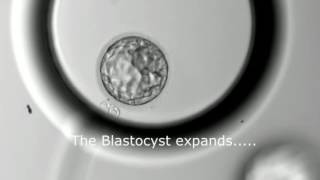 Blastocyst Development  Day 3 to Day 5 MUST SEE [upl. by Ayyn359]