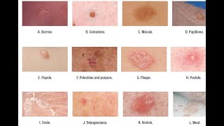 Skin Lesions with defination [upl. by Haase214]