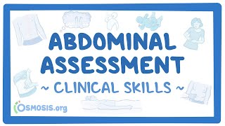 Abdominal Assessment Clinical Skills [upl. by Aicirt407]