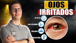 8 REMEDIOS NATURALES PARA LOS OJOS IRRITADOS [upl. by Howlan]