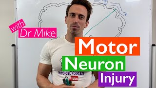 Motor Neuron Injury [upl. by Sine]