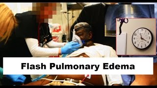 Flash Pulmonary Edema Emergency [upl. by Au]