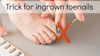 How to Fix Ingrown Toenails Easily [upl. by Iorio608]