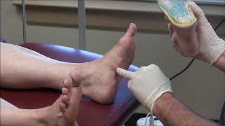 Plantar Fasciitis Causes Symptoms amp Treatment [upl. by Elvin441]