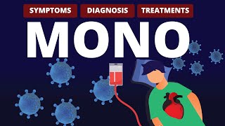 What is MONO Symptoms Diagnosis amp Treatments [upl. by Nevah]