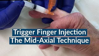 Trigger Finger Injection  The MidAxial Approach [upl. by Osher]