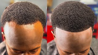 HOW TO FIX A BALDING RECEDING HAIRLINE  PERFECT HAIRCUT FIX [upl. by Dnaltroc]